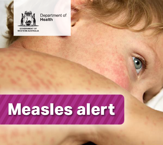 Measles alert