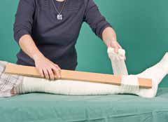 splint being applied over bandaged leg