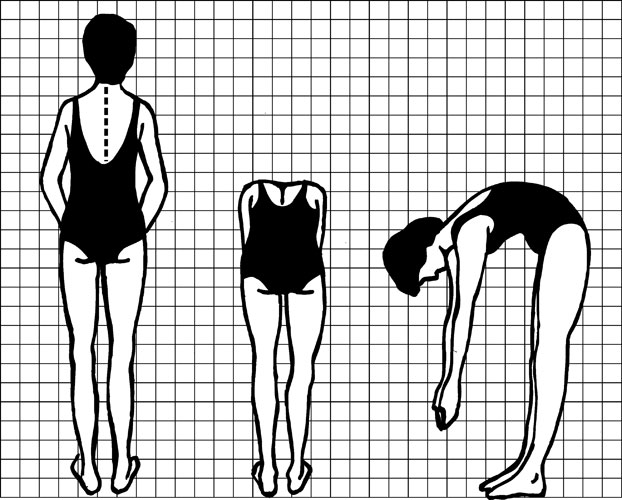 Diagram showing a person performing the tests used to look for signs of scoliosis